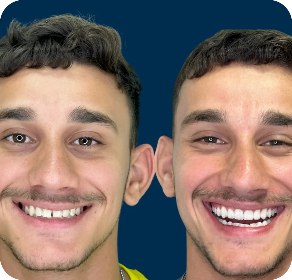 dep-0002
